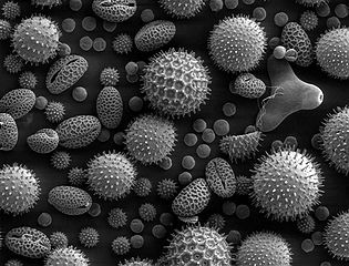 A variety of pollen grains and spores viewed under a microscope, showcasing different shapes and textures with a black background.