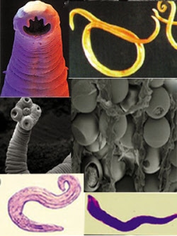 Parasites Parasites and their Cysts