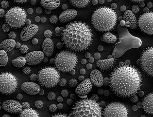 A variety of pollen grains and spores viewed under a microscope, showcasing different shapes and textures with a black background.