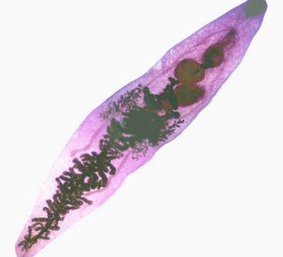 Microscopic view of a liver fluke, a parasitic flatworm, showing its elongated, segmented body structure under a light microscope.